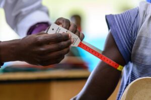 A-remote-doctor-measure-for-malnutrition-in-jinja-hospitalUganda